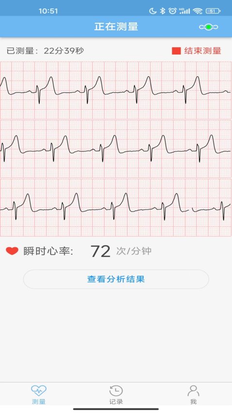 数维康心电手机版
