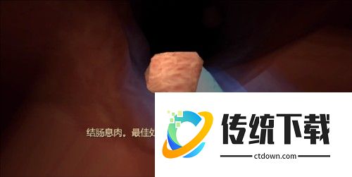 大肠的复仇